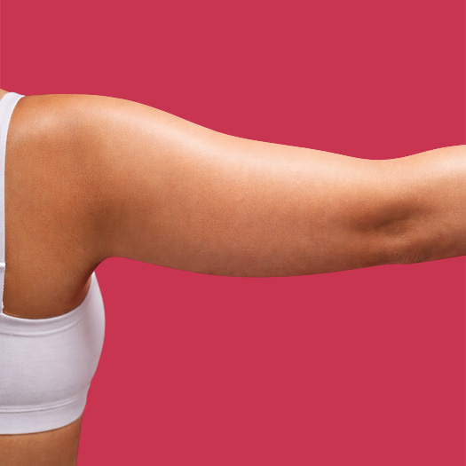 lifting-des-bras